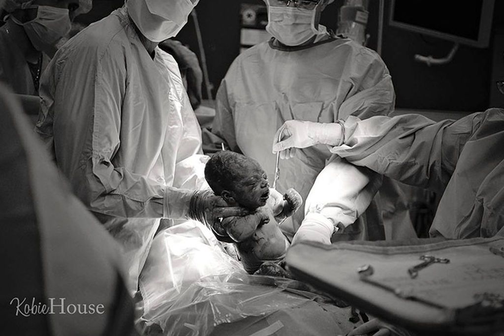 12+1 εκπληκτικές φωτογραφίες που αποτυπώνουν τη μαγεία του τοκετού με καισαρική τομή!