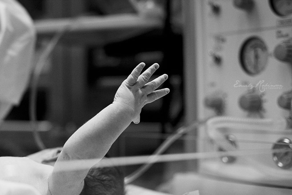 12+1 εκπληκτικές φωτογραφίες που αποτυπώνουν τη μαγεία του τοκετού με καισαρική τομή!