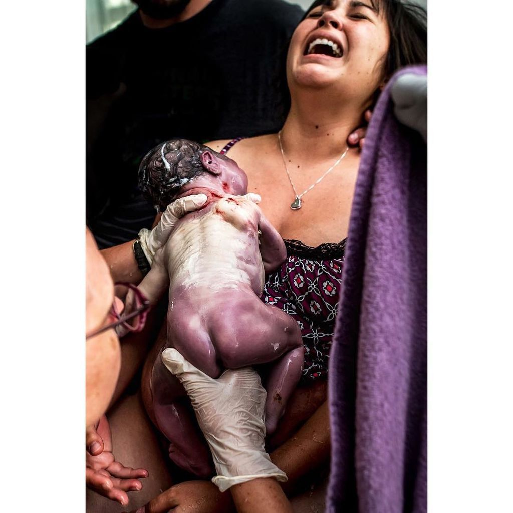 Μοναδικές φωτογραφίες μωρών τη στιγμή της γέννησής τους (pics)