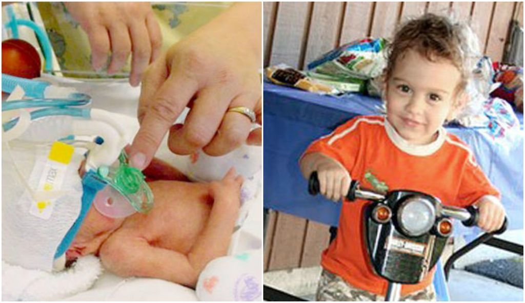 Ο Carson γεννήθηκε στην 26η εβδομάδα. Όταν τραβήχτηκε η φωτογραφία ήταν 2 χρόνων