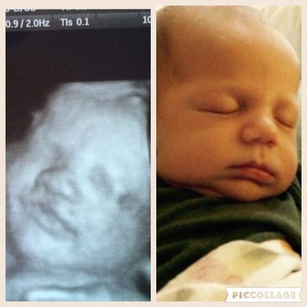 Γονείς συγκρίνουν τα μωρά με φωτογραφίες από υπερήχους. Το αποτέλεσμα, θα σας εντυπωσιάσει (pics)