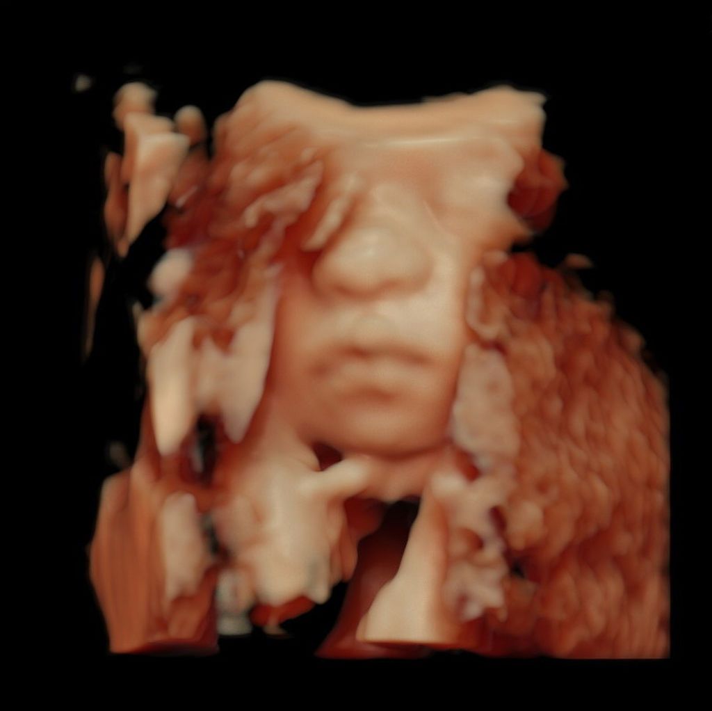 Διανύει τον 7ο μήνα της εγκυμοσύνης της και μας δείχνει 3D υπέρηχο του μωρού της (pics)