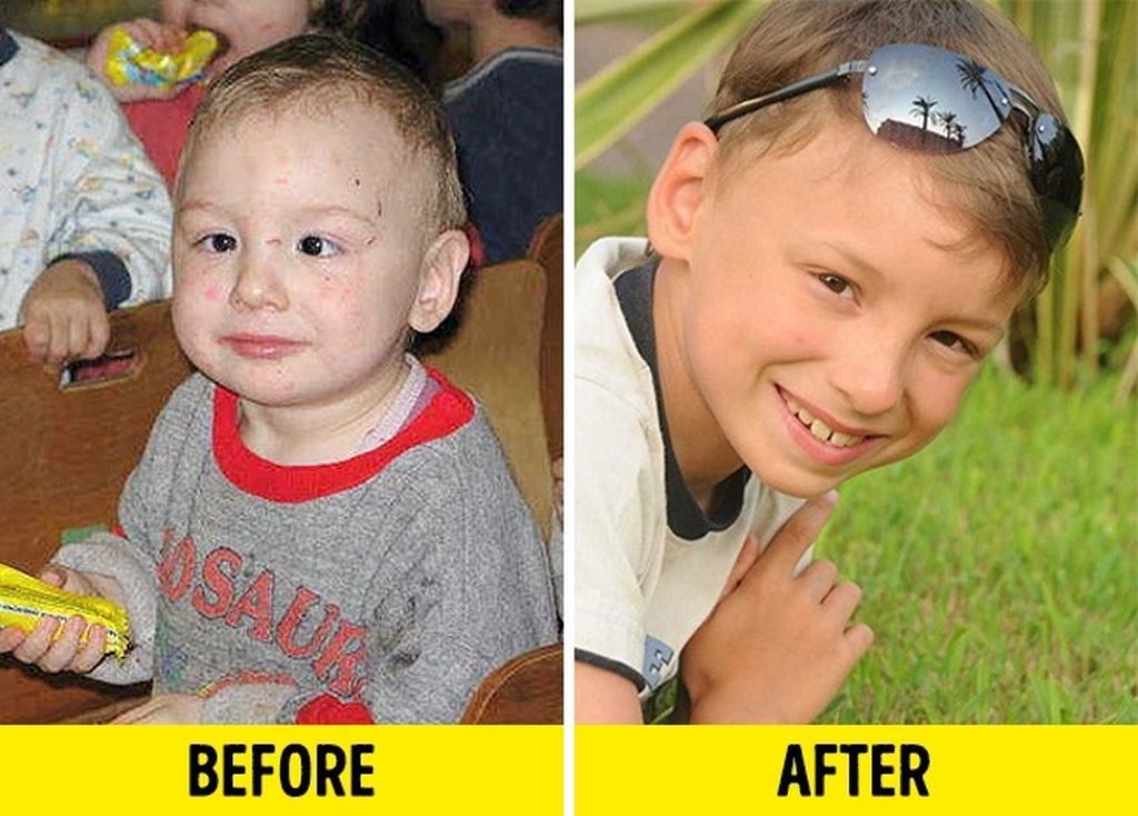 Φωτογραφίες παιδιών πριν και μετά την υιοθεσία, θα σας φέρουν δάκρυα στα μάτια (pics)