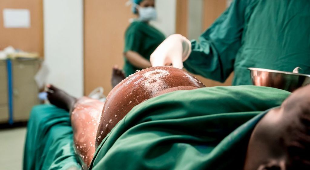 Τοκετός - Τρίτη Θέση: Laura Wando of Laura Cate Photography – Serving Kampala, Uganda  – “Πριν την καισαρική”