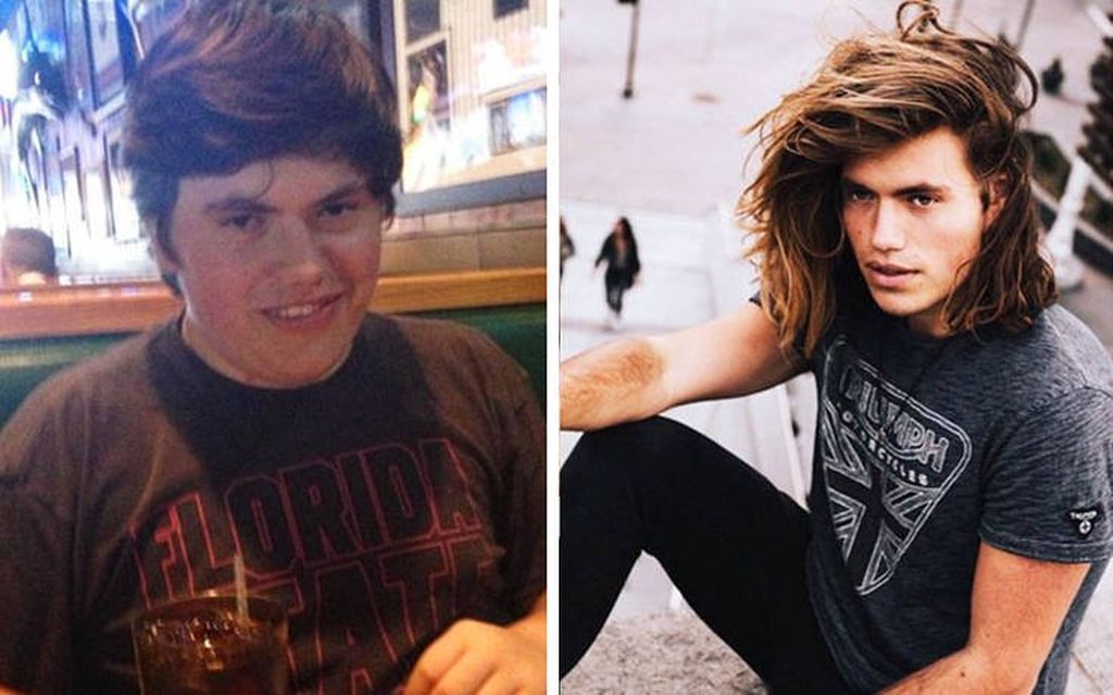 Θα εντυπωσιαστείτε! Δείτε πώς ήταν 20 άνθρωποι στην εφηβεία  τους και πώς είναι σήμερα (pics)