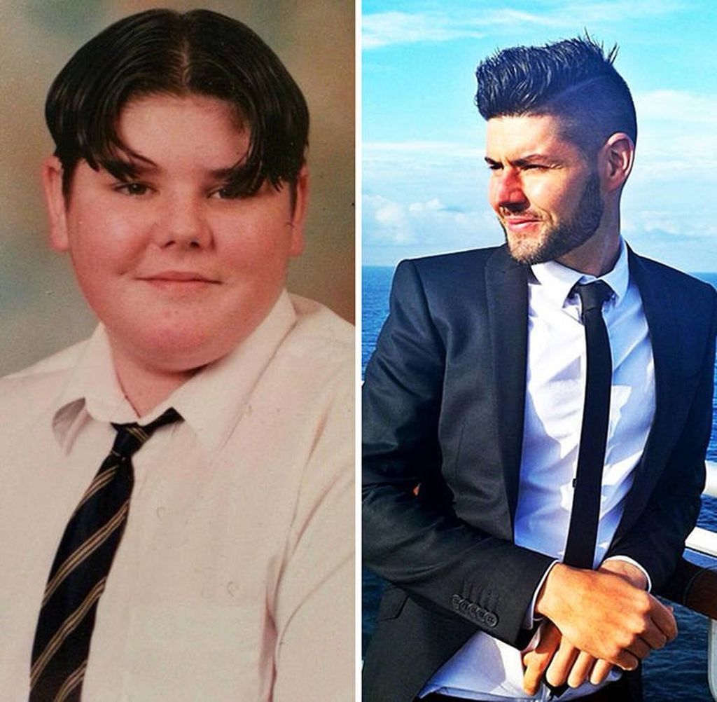 Θα εντυπωσιαστείτε! Δείτε πώς ήταν 20 άνθρωποι στην εφηβεία  τους και πώς είναι σήμερα (pics)