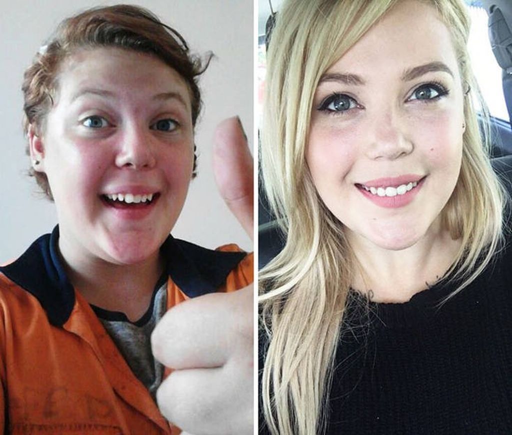 Θα εντυπωσιαστείτε! Δείτε πώς ήταν 20 άνθρωποι στην εφηβεία  τους και πώς είναι σήμερα (pics)