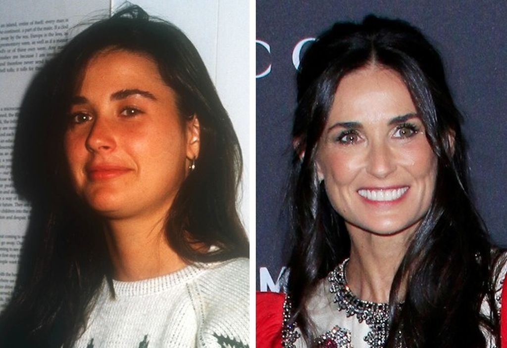 Το πριν και το μετά: Θα πάθετε πλάκα όταν δείτε πώς ήταν στα νιάτα τους 10 διάσημοι (pics)