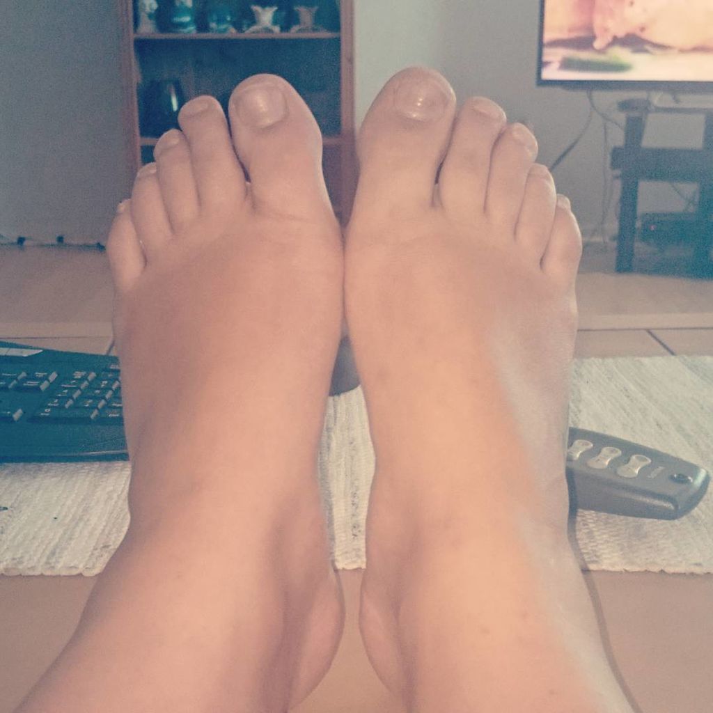 Πρησμένα πόδια: Εδώ θα πείτε: «Βοήθεια, δεν αναγνωρίζω πια τα πόδια μου!». Όλη αυτή η επιπλέον πίεση από το αναπτυσσόμενο σώμα σας μπορεί να οδηγήσει σε πρησμένα πόδια, δίνοντάς σας αυτή την εμφάνιση που βλέπετε και στη φωτογραφία. Ξαφνικά τα κομψά σας πα