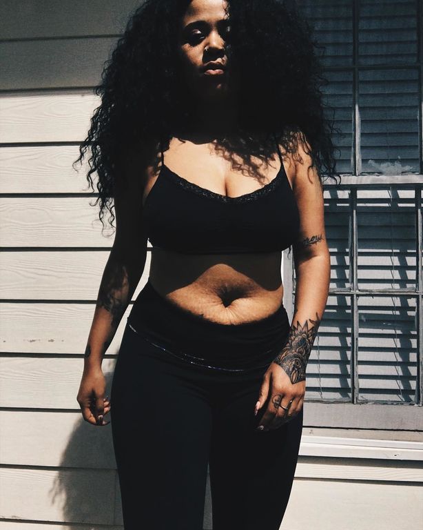 Δεκαπέντε συγκλονιστικές φωτογραφίες, το καλύτερο μήνυμα για το γυναικείο σώμα μετά την εγκυμοσύνη