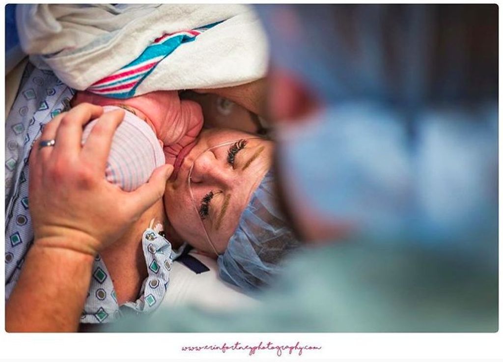 Καισαρική τομή: Τα πρόσωπα των μαμάδων σε αυτές τις φωτογραφίες μιλούν από μόνα τους