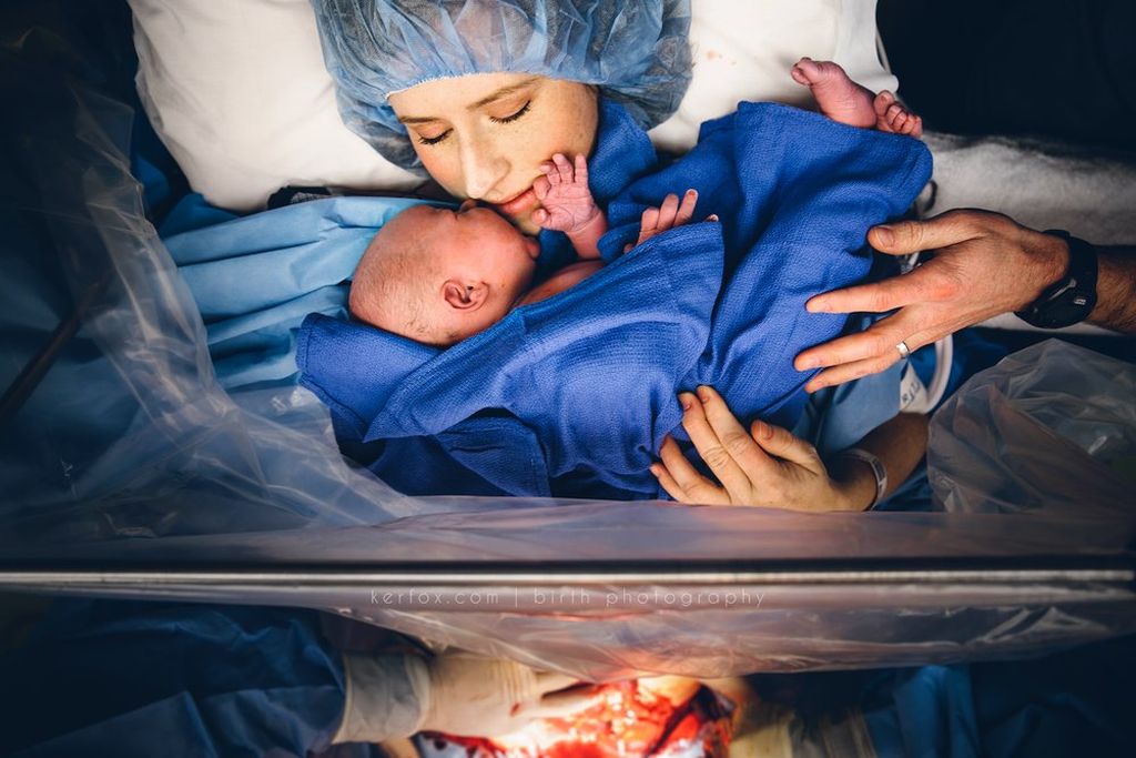 Καισαρική τομή: Τα πρόσωπα των μαμάδων σε αυτές τις φωτογραφίες μιλούν από μόνα τους