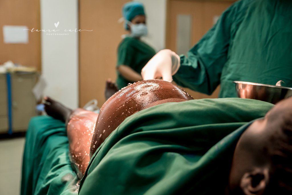 Καισαρική τομή: Τα πρόσωπα των μαμάδων σε αυτές τις φωτογραφίες μιλούν από μόνα τους