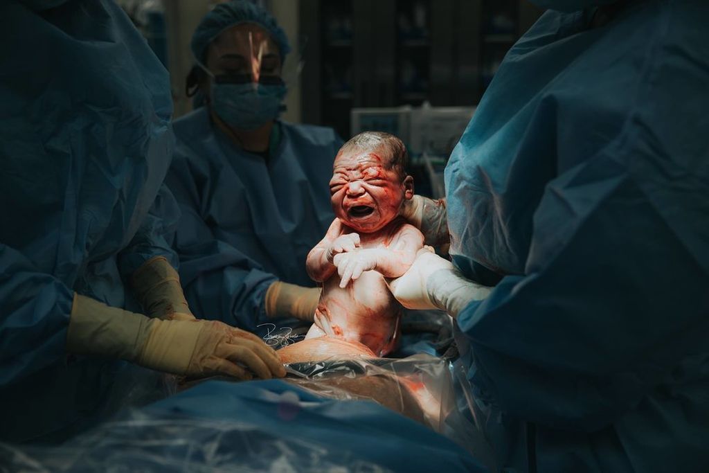 Καισαρική τομή: Τα πρόσωπα των μαμάδων σε αυτές τις φωτογραφίες μιλούν από μόνα τους