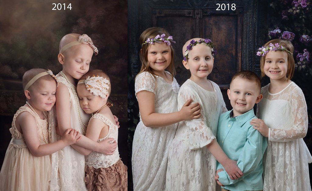 Η τρυφερή φωτογράφηση τριών κοριτσιών που κέρδισαν τον καρκίνο, έγινε viral