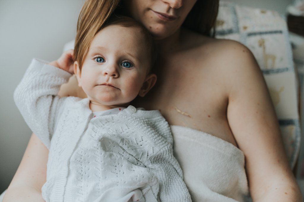 Φωτογράφος μετατρέπει τα σημάδια και τις ραγάδες των γυναικών σε «χρυσά» έργα τέχνης