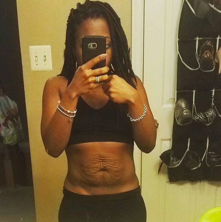 Σώμα μετά τη γέννα: Δεν θα ντραπείς ποτέ ξανά να δείξεις το κορμί σου, μόλις δεις αυτές τις μαμάδες