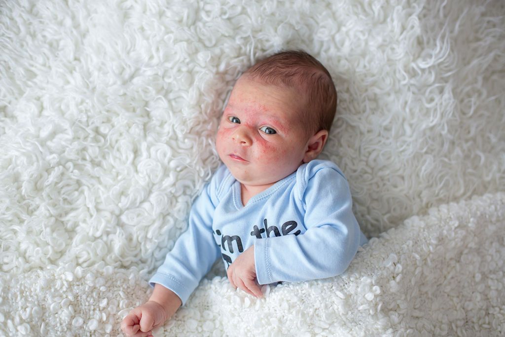 Αυτά είναι τα συμπτώματα που δείχνουν πρόβλημα με την υγεία του παιδιού