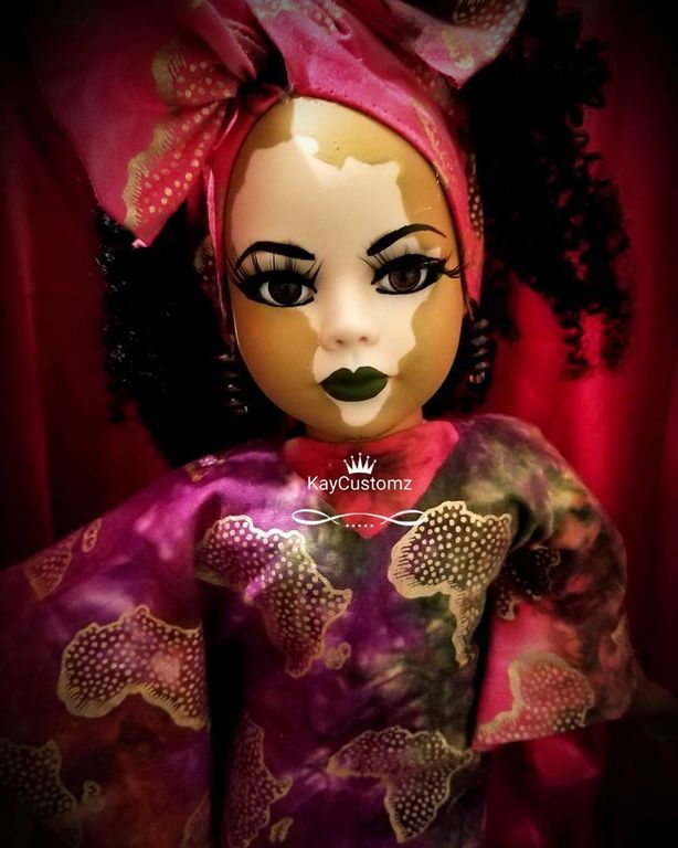 Καλλιτέχνης δημιουργεί κούκλες για τα παιδιά με λεύκη (pics & vid)