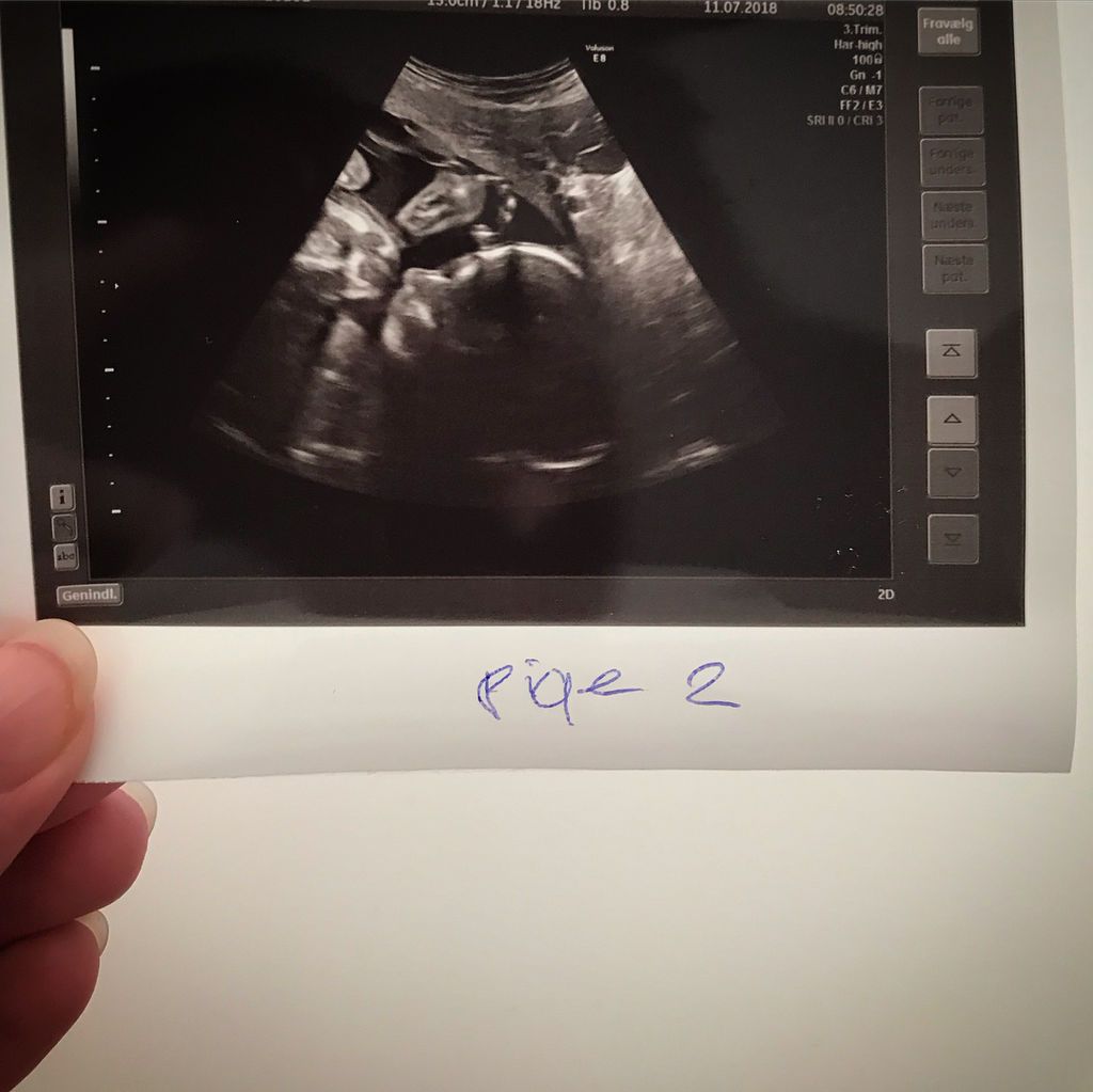 Μια μαμά μας δείχνει πώς μοιάζει να είσαι έγκυος σε τρίδυμα (pics+vid)