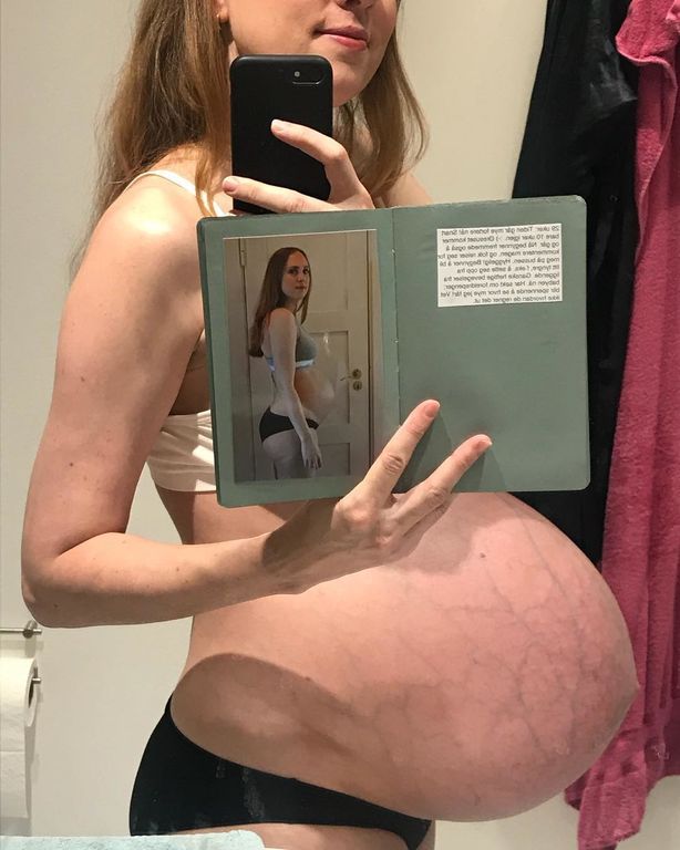 Μια μαμά μας δείχνει πώς μοιάζει να είσαι έγκυος σε τρίδυμα (pics+vid)