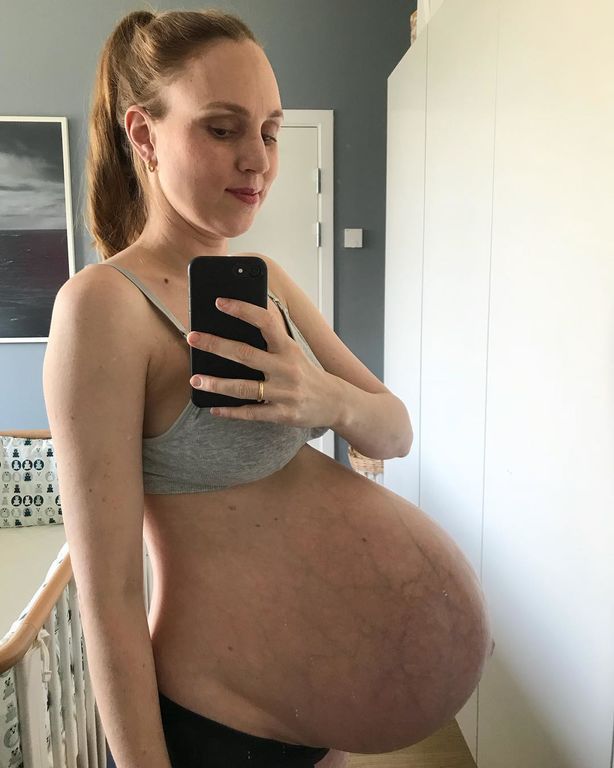 Μια μαμά μας δείχνει πώς μοιάζει να είσαι έγκυος σε τρίδυμα (pics+vid)