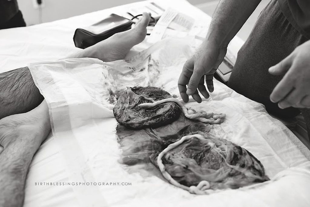 Απίστευτο: Αυτός ο πατέρας ξεγέννησε τα δίδυμά τους μέσα στη μπανιέρα (pics)