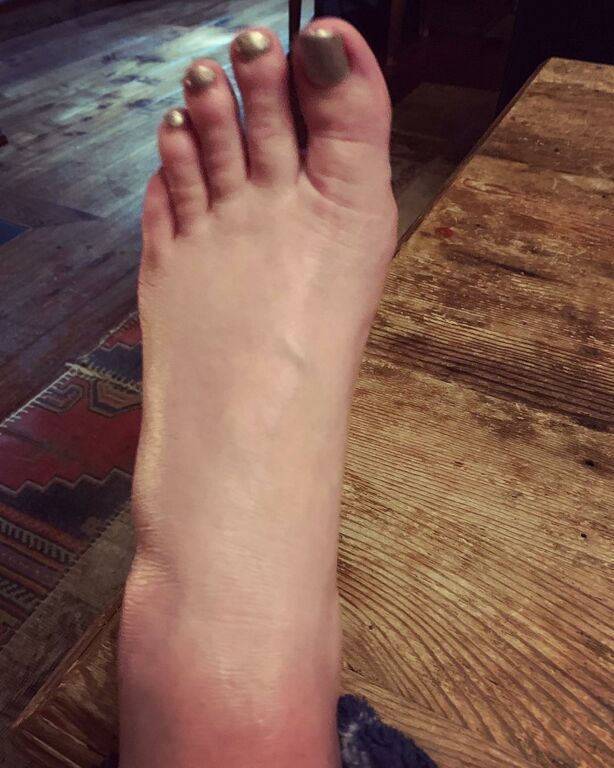 Εγκυμονούσα ηθοποιός νοσηλεύτηκε με βρογχίτιδα - Η φώτο και το μήνυμα στο Instagram (pics)