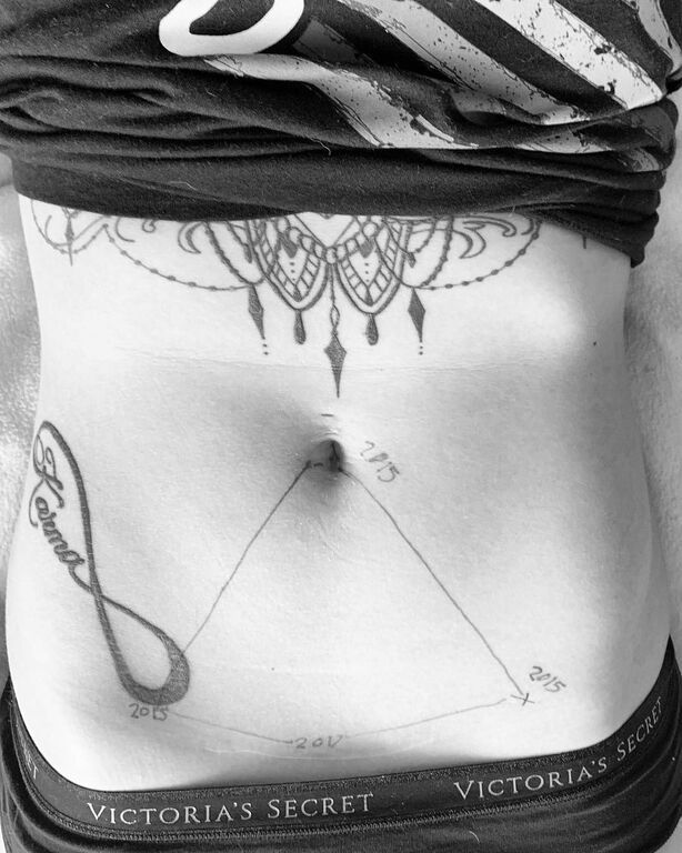 Γυναίκες δείχνουν πώς μοιάζει η ενδομητρίωση μέσα από τα σημάδια τους (pics)