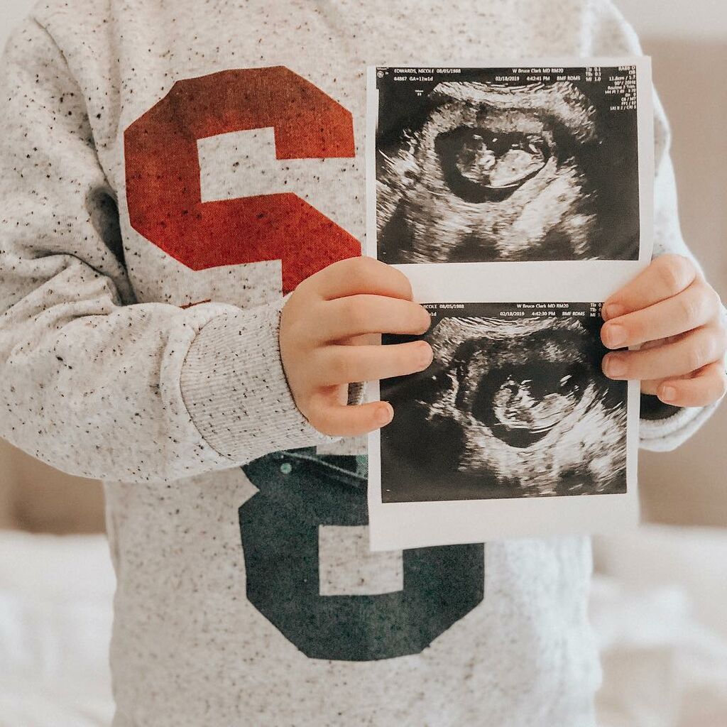 Είναι έγκυος για δεύτερη φορά και δεν μπορεί να κρύψει το πόσο χαρούμενη είναι! (pics)