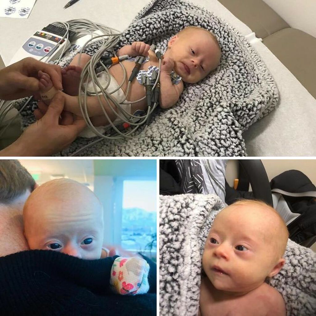 Δημοσίευσε φωτογραφίες με την κόρη της που έχει σύνδρομο Down - Πάνω από 347.000 χρήστες τη λάτρεψαν