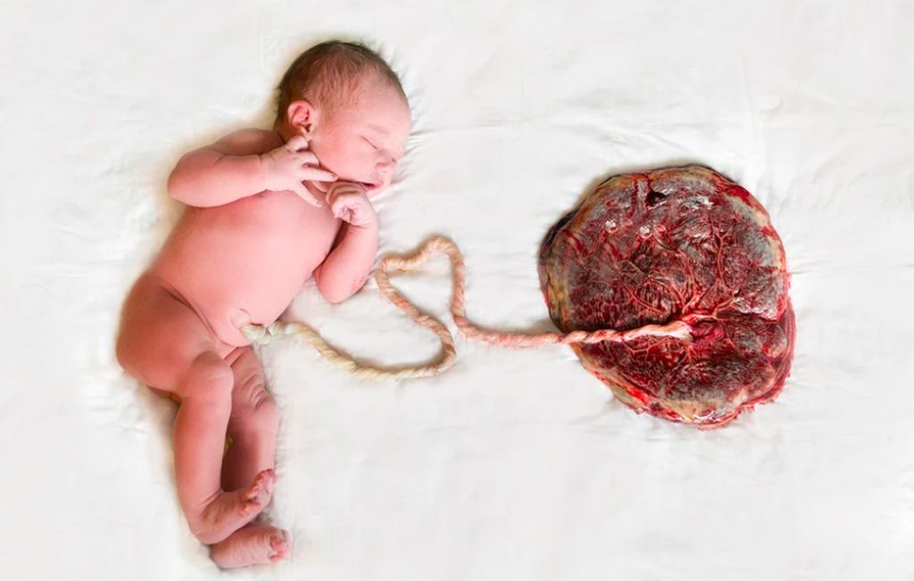 Γυναίκα γεννά σε νερό - O τρόπος που κόβει τον ομφάλιο λώρο θα σας αφήσει άφωνους (pics)