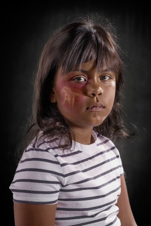 Η λεκτική βία αφήνει σημάδια - Συγκλονιστικές φωτογραφίες (pics)