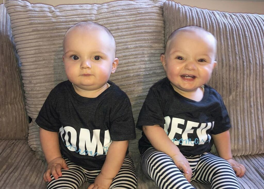 Δίδυμα επέζησαν από εγχείρηση μέσα στη μήτρα και γιορτάζουν τα πρώτα τους γενέθλια (vid & pics)