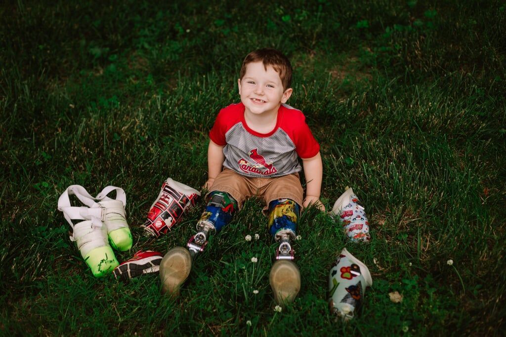 Μαθήματα θέλησης από ένα 3χρονο - H συγκινητική ιστορία του μικρού Ryker (pics)