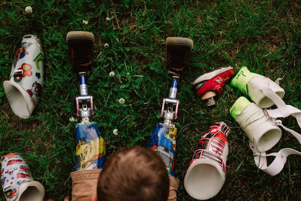 Μαθήματα θέλησης από ένα 3χρονο - H συγκινητική ιστορία του μικρού Ryker (pics)