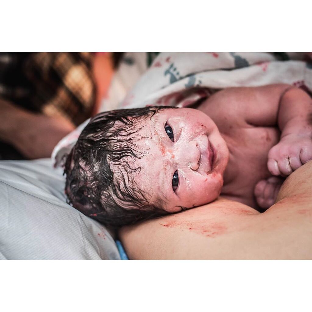 Γεννήθηκε με κεφάλι γεμάτο μαλλάκια, ορθάνοιχτα μάτια και ένα μεγάλο χαμόγελο (pics)