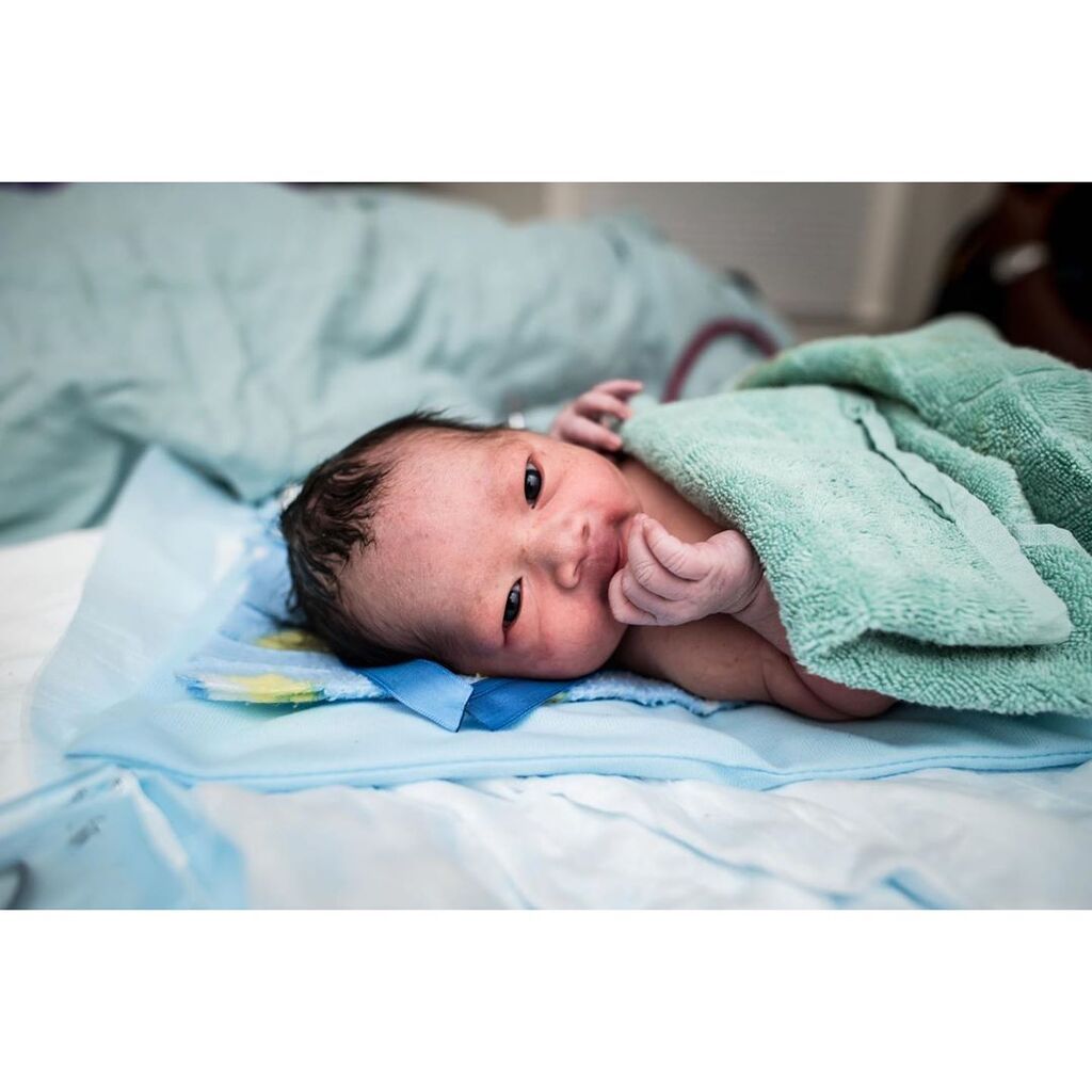 Γεννήθηκε με κεφάλι γεμάτο μαλλάκια, ορθάνοιχτα μάτια και ένα μεγάλο χαμόγελο (pics)