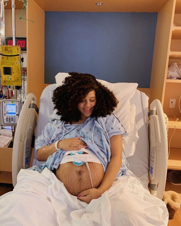 Εγκυμοσύνη διδύμων: Μέλλουσες μαμάδες μας δείχνουν τις κοιλίτσες τους και είναι υπέροχες (pics)