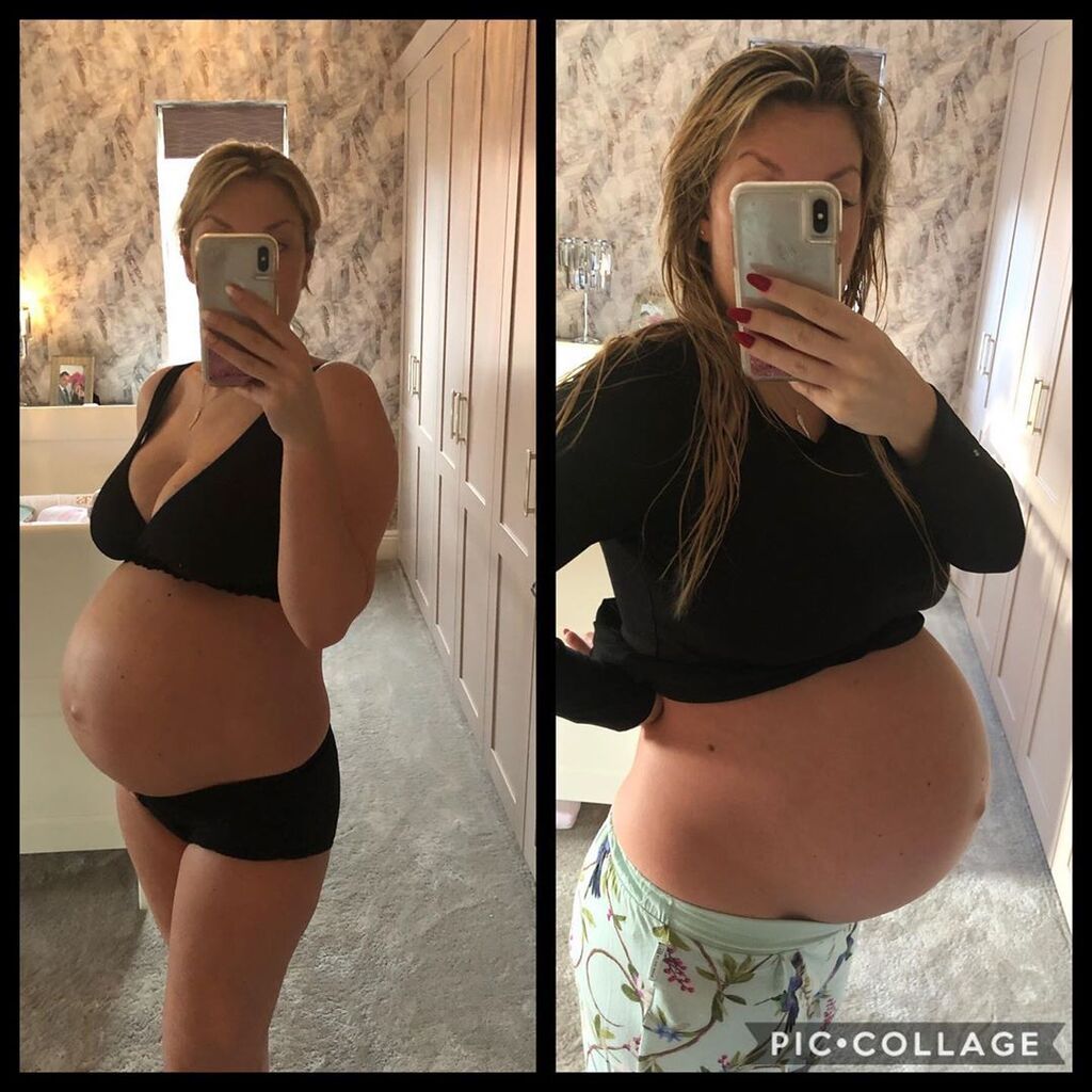 Εγκυμοσύνη διδύμων: Μέλλουσες μαμάδες μας δείχνουν τις κοιλίτσες τους και είναι υπέροχες (pics)