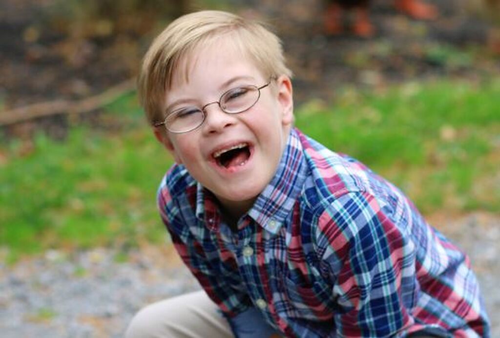 Απίθανες φωτογραφίες παιδιών με Σύνδρομο Down αποδεικνύουν πόσο υπέροχα είναι (pics)