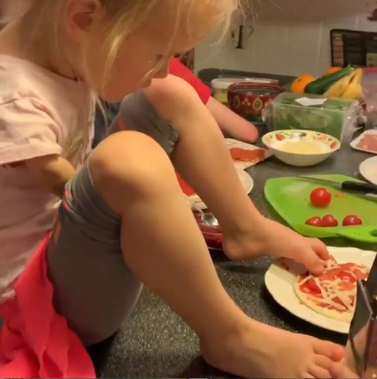 Η μικρούλα γεννήθηκε χωρίς χέρια κι όμως τρώει μόνη της