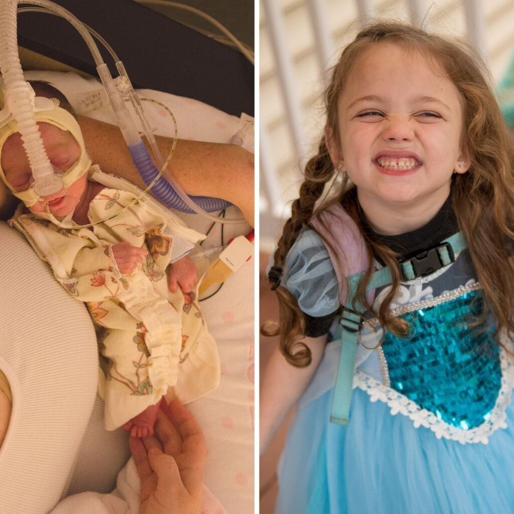 Γέννησε πρόωρα και η φωτογραφία της συγκινεί