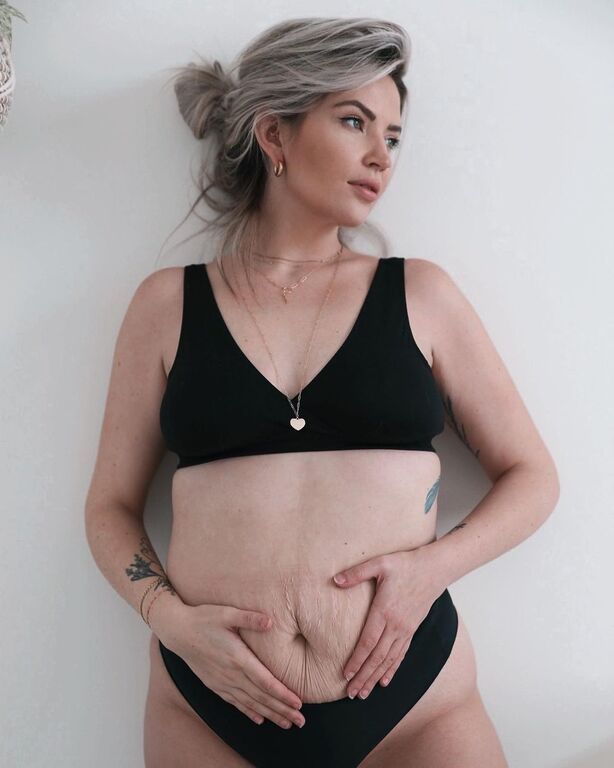 Οι φωτογραφίες αυτής της μαμάς πριν και μετά τη γέννα έγιναν viral 