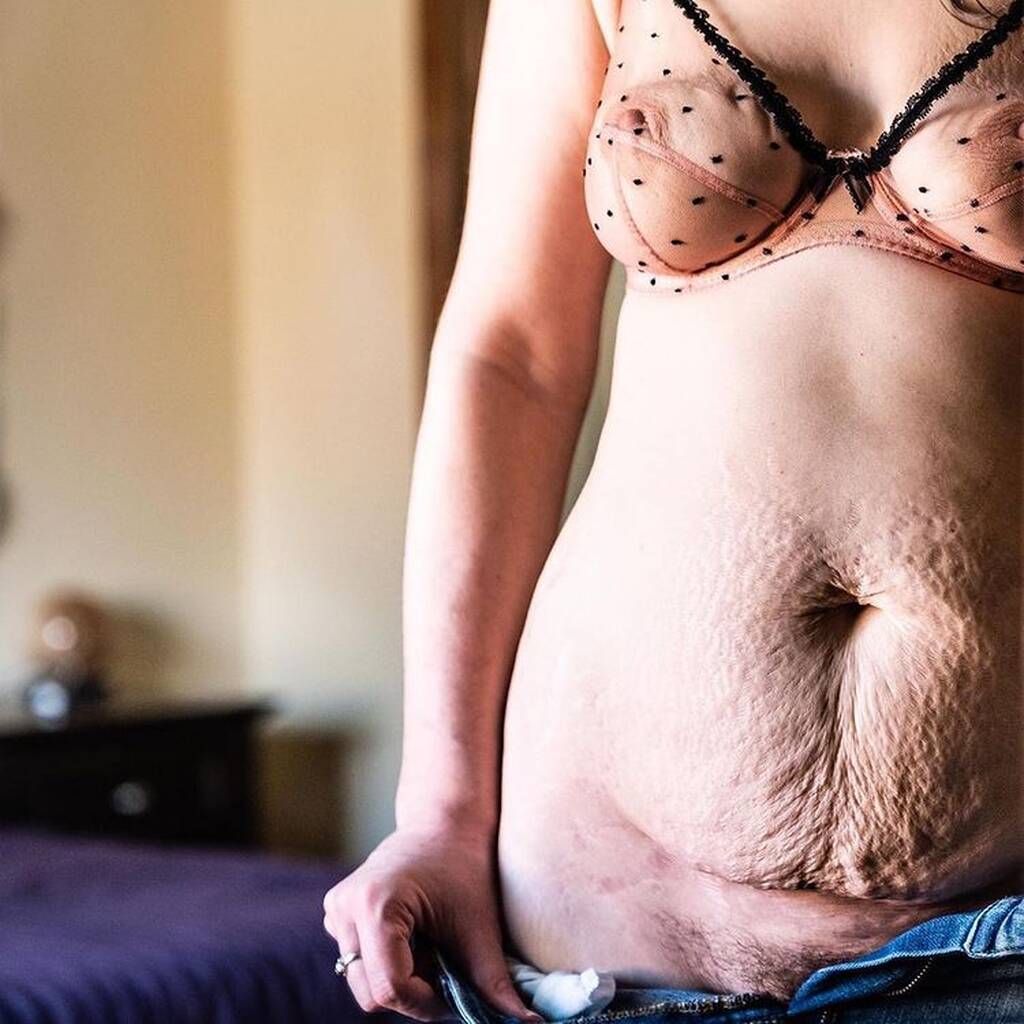 Instagram @takebackpostpartum / @chelseadelaniephoto 