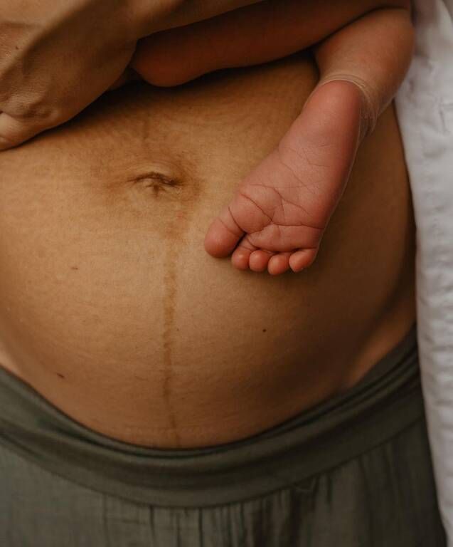 Πηγή φωτογραφίας: Instagram / fotografie_eweliny