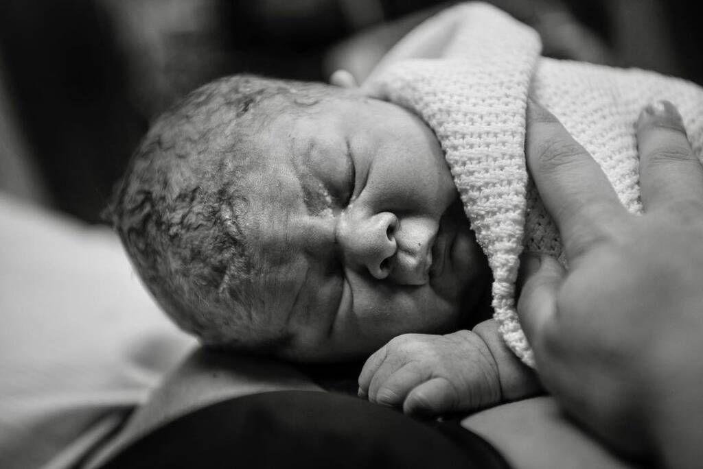 Φωτογραφίες αποτυπώνουν τις στιγμές του τοκετού με τον πιο ρεαλιστικό τρόπο