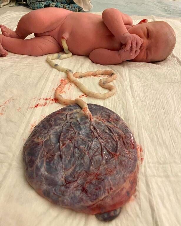 Πηγή φωτογραφίας: Instagram / allthingsbirthandbalance