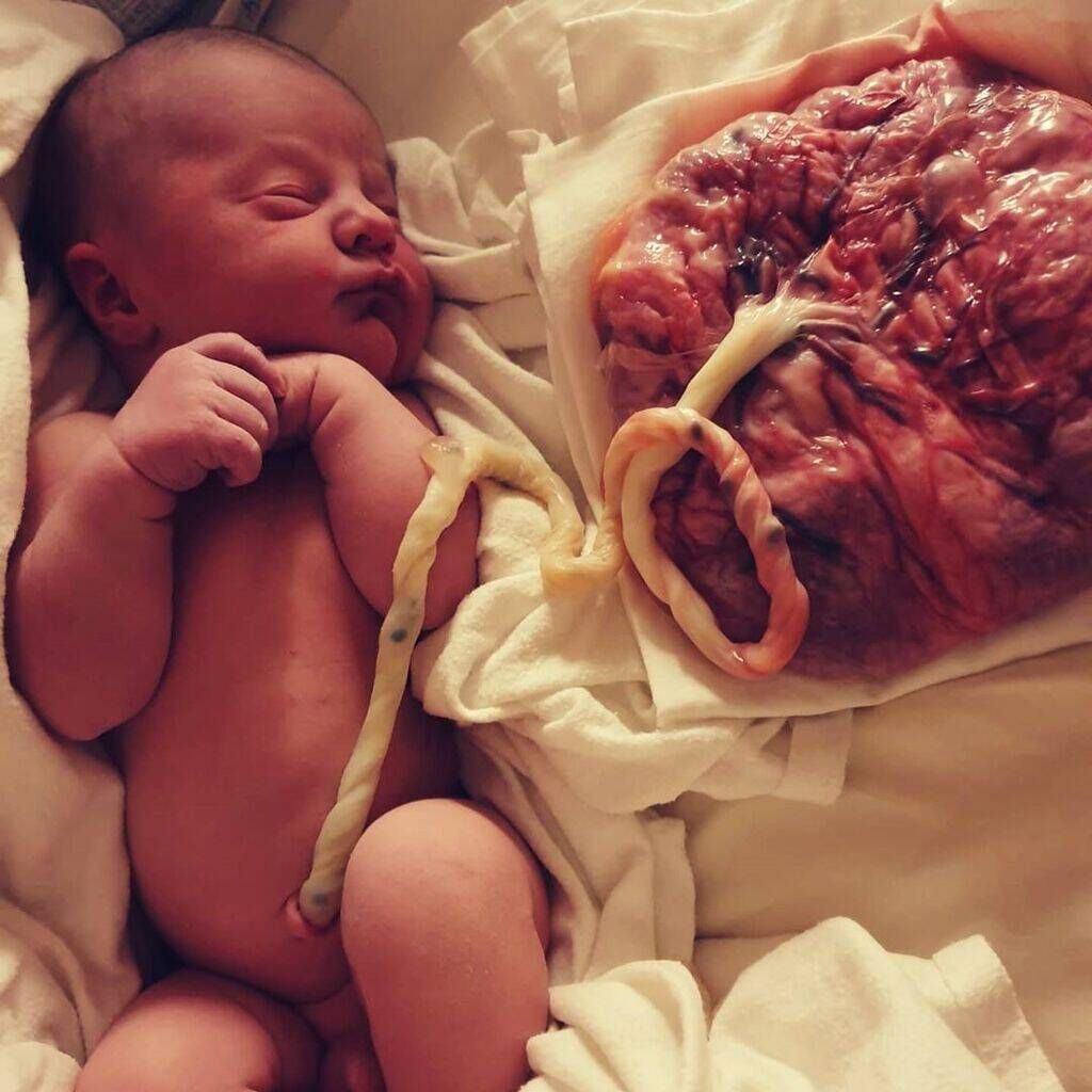 Πηγή φωτογραφίας: Instagram / ostetrica.giulia