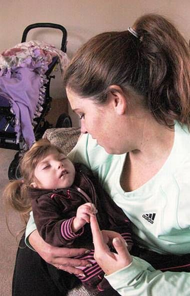 Τα παιδιά που στην πραγματικότητα πάσχουν από το σύνδρομο Μπέντζαμιν Μπάτον (εικόνες)